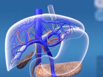 难发现、易转移、难治疗 胰腺癌为何如此凶险？